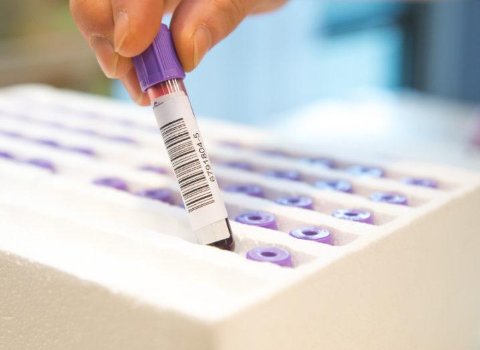 Universal-blood-type