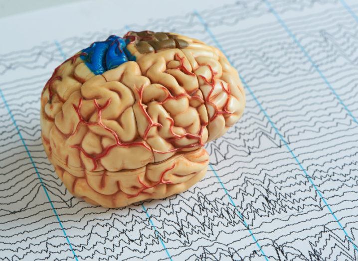brain