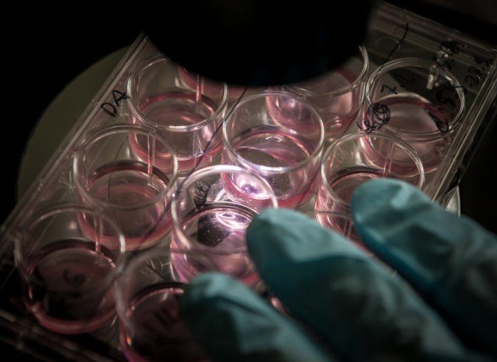 Bioprinting